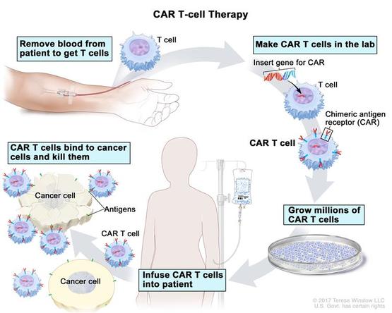 CAR-T Therapy